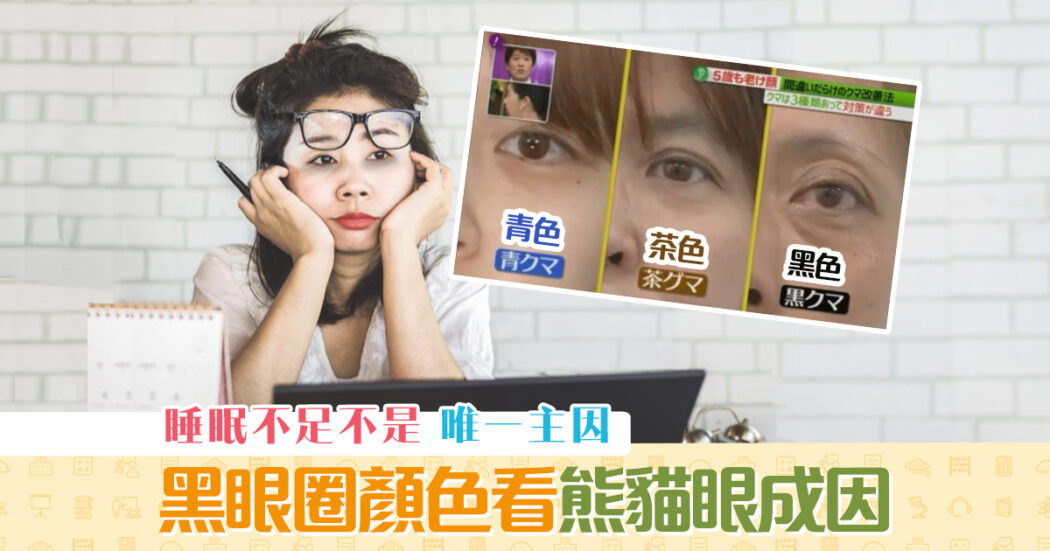 健康資訊-黑眼圈-熊貓眼-成因-改善方法og