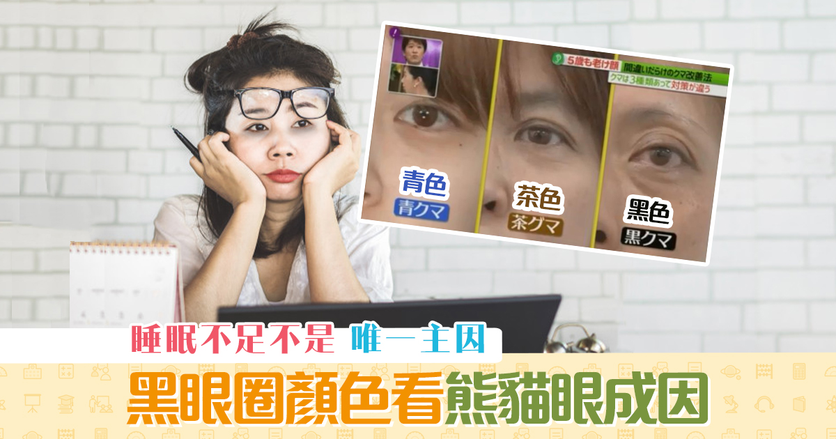 健康資訊-黑眼圈-熊貓眼-成因-改善方法